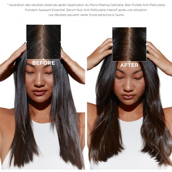 Sérum Cellulaire Nuit Anti-pelliculaire Intensif Symbiose Kérastase 90ML 6 Sérum Cellulaire Nuit Anti-pelliculaire Intensif Symbiose Kérastase 90ML – Image 4